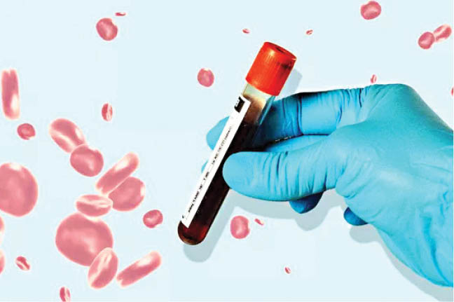 تشخیص زودهنگام سرطان با آزمایش خون ساده