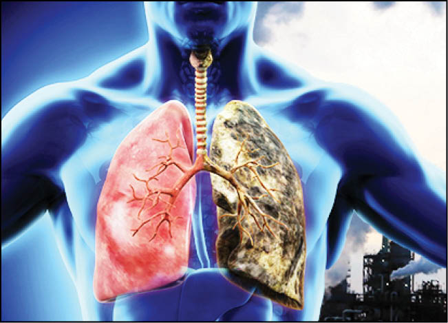 کشف علت سرطان ریه در غیرسیگاری‌ها