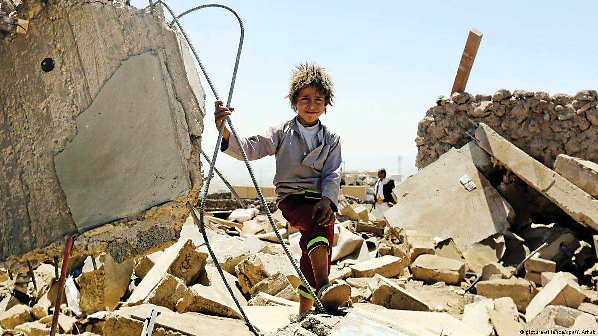 گلوله و گرسنگی؛ سهم کودکان یمنی از جنگ