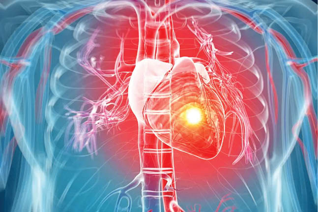 درمان نارسایی قلبی با سلول‌های بنیادی