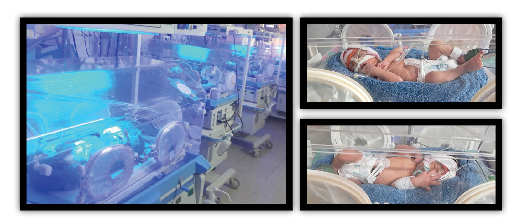 زایمان 2 مادر در بیمارستان تبریز با تولد پنج‌قلوها و چهارقلوها همراه بود